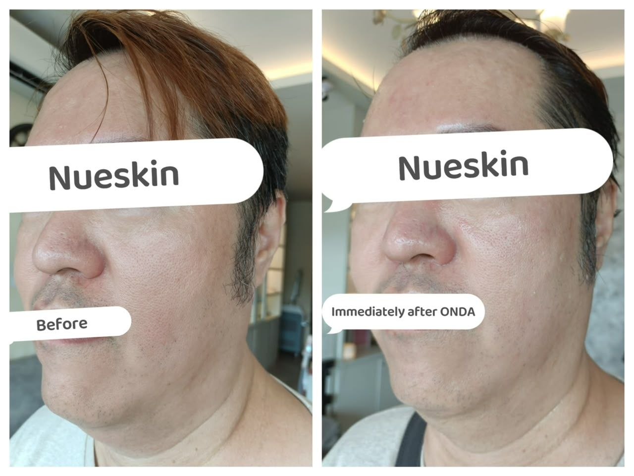 Face Contouring before and after — Nue Skin Beauty Esthetique