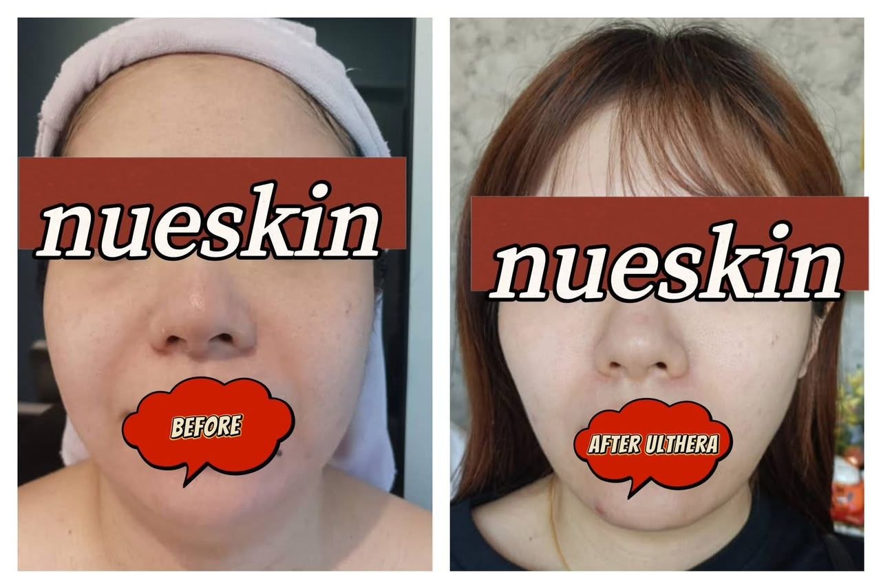 Face Contouring before and after — Nue Skin Beauty Esthetique