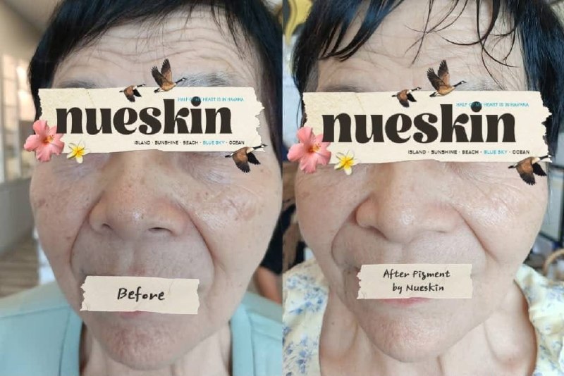 Client treatment result before and after — Nue Skin Beauty Esthetique