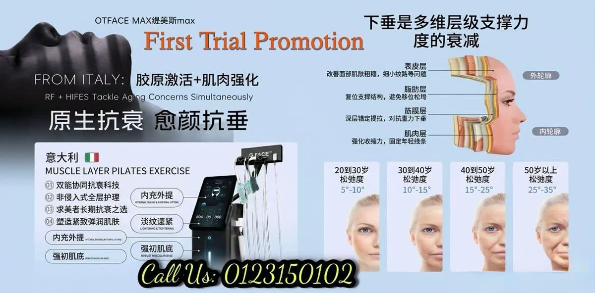 OTFACE MAX Triple Facelift diagram — RF plus HIFES muscle-layer treatment, facial anatomy layers and age-progressive before and after results from 20s to 50+ — Nue Skin Beauty Esthetique