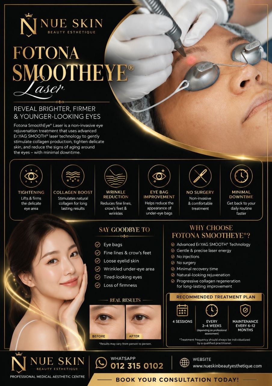 Fotona Smooth Eye Laser poster — reveal brighter, firmer and younger-looking eyes with Er:YAG SMOOTH laser technology, before and after results — Nue Skin Beauty Esthetique