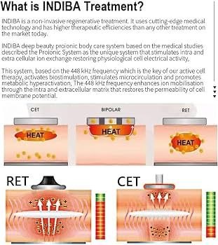 INDIBA Proionic radiofrequency treatment — how the 448 kHz current works inside facial tissue — Nue Skin Beauty Esthetique